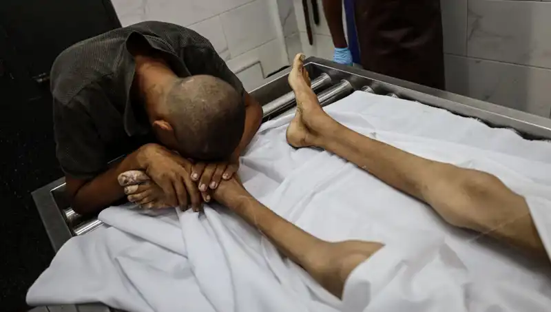 Gazze'de Açlıktan Kaybedilen Hayatlar: Bir Çocuk Daha Hayatını Kaybetti